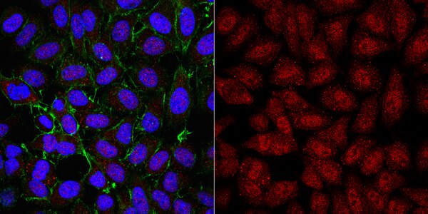 Anti-TERT Antibody | ABE2075